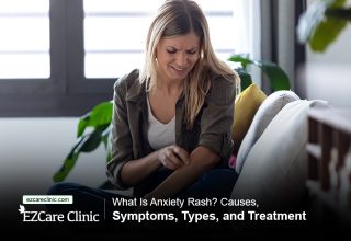 Anxiety Rash