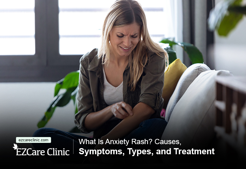 Anxiety Rash